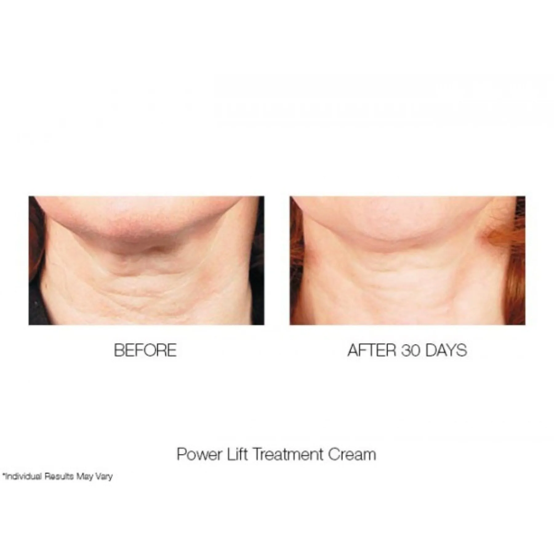 Power Lift Treatment Cream Moisturiser